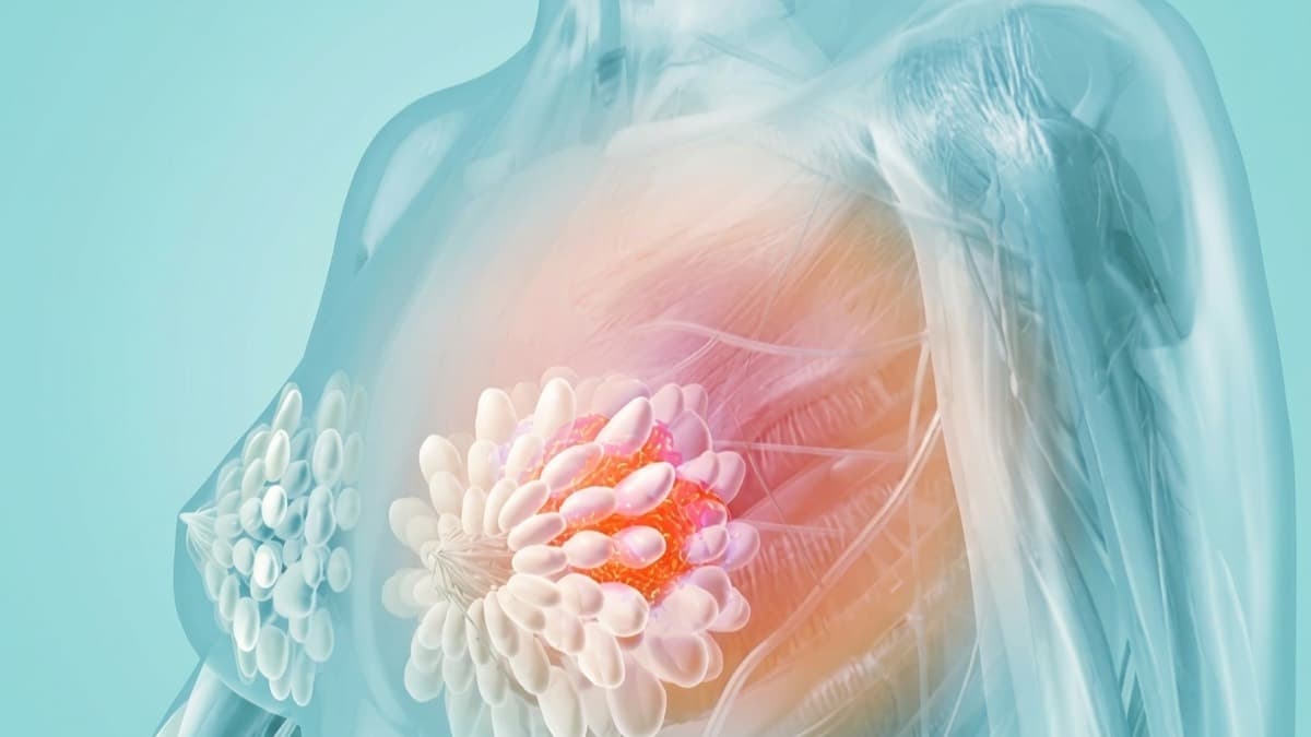 乳腺增生與乳房健康中醫調理示意圖