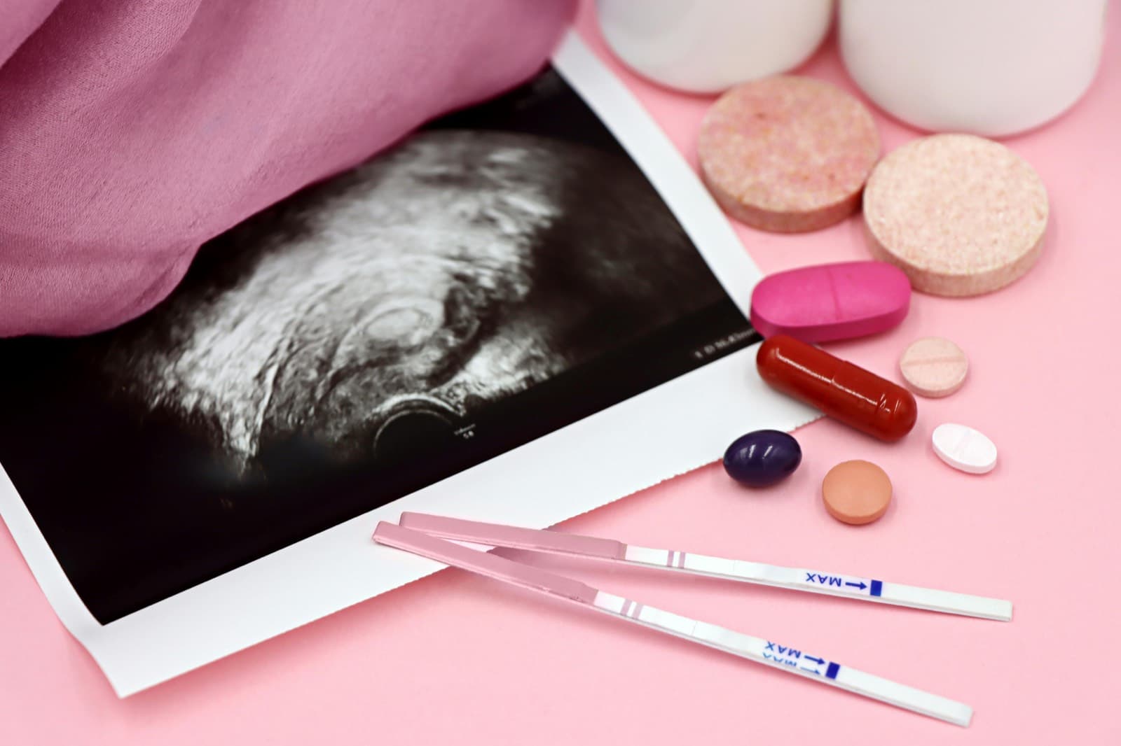 備孕與懷孕檢查用品示意圖,用於香港中醫備孕與 IUI IVF 前後調理頁面